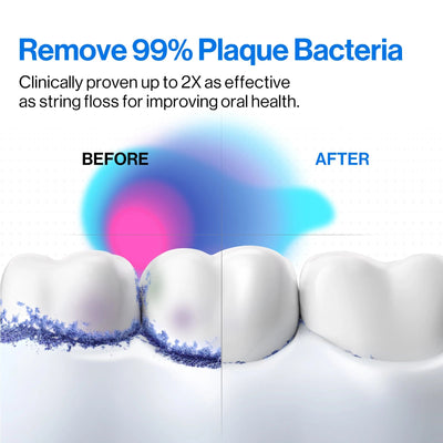 C10 Portable Dental Water Flosser